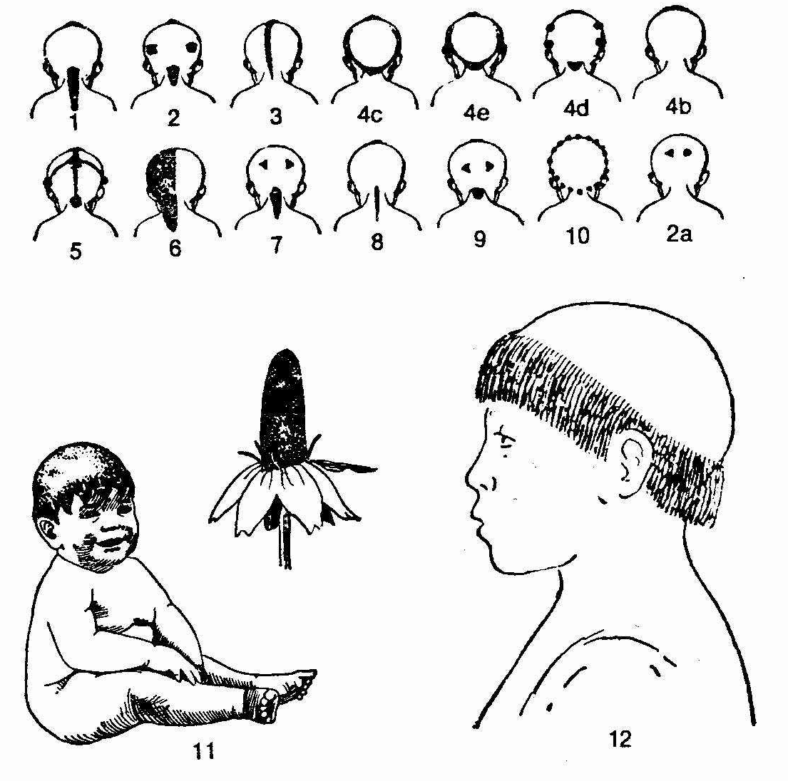 La Flasche, The OsageTribe(1928)におけるクラン親族に対応するトーテム動植物に対応する子供のヘアスタイル